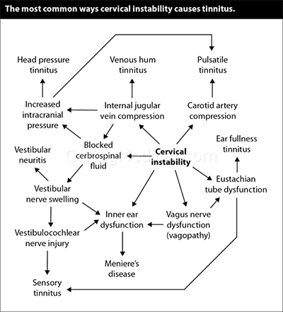 Tinnitus and Cervical Spine Instability Connection