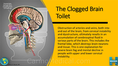 Is Your Brain Clogged?